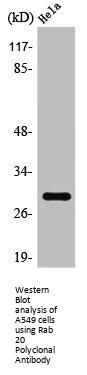 RAB20 Antibody