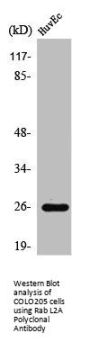 RABL2A Antibody