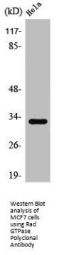 RRAD Antibody