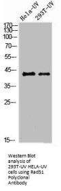 RAD51 Antibody