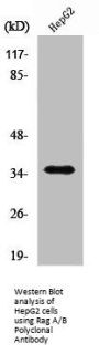 RRAGA/RRAGB Antibody
