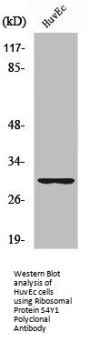 RPS4Y1 Antibody