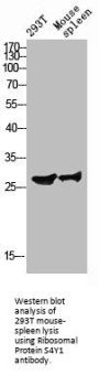 RPS4Y1 Antibody