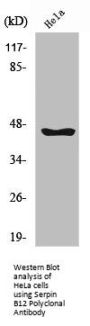 SERPINB12 Antibody