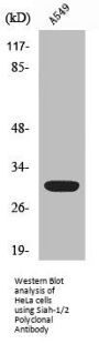 SIAH1/SIAH2 Antibody