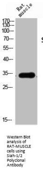 SIAH1/SIAH2 Antibody