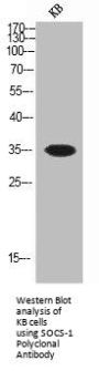 SOCS1 Antibody
