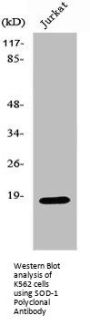 SOD1 Antibody