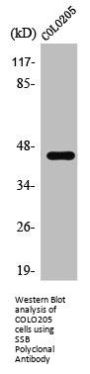 SSB Antibody