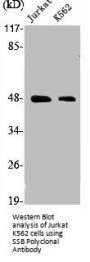SSB Antibody