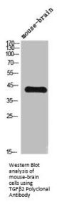 TGFB2 Antibody