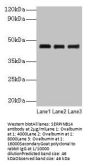SERPINB14 Antibody