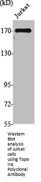 TOP2A Antibody