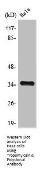 TPM1 Antibody