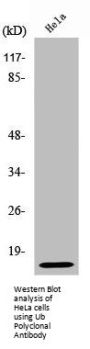 UBB/UBC/RPS27A/UBA52 Antibody