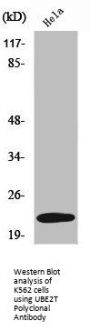 UBE2T Antibody