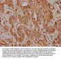 CACNA1A Antibody