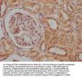CACNA1B Antibody