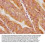 CACNA1H Antibody