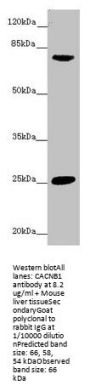 CACNB1 Antibody