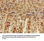 CACNB4 Antibody