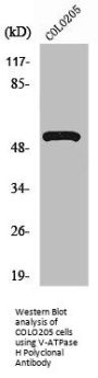 ATP6V1H Antibody