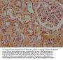 CALB1 Antibody