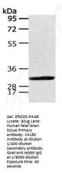 CALB2 antibody