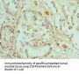 CALD1 Antibody