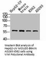 VIM Antibody