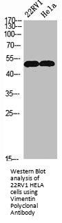 VIM Antibody