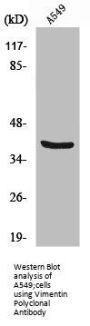 VIM Antibody