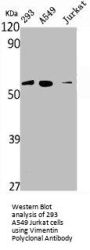 VIM Antibody