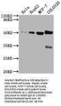 CALR Antibody