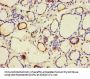 CALR Antibody
