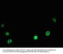 CALR Antibody