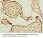 CALU Antibody