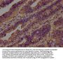 CAP1 Antibody