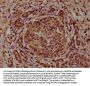 CAP1 Antibody
