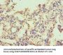 CAPN1 Antibody