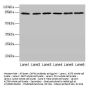 Rabbit anti-human Calpain-1 catalytic subunit polyclonal Antibody(CAPN1)