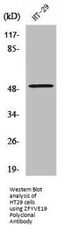 ZFYVE19 Antibody