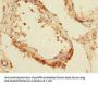 CBFA2T2 Antibody