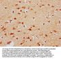 CBX4 Antibody