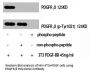 PDGFRB Antibody