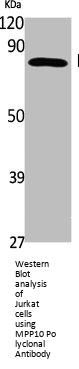 MPHOSPH10 Antibody