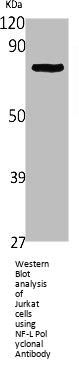 NEFL Antibody