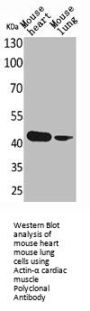 ACTC1 Antibody
