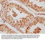 CCHCR1 Antibody
