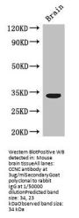CCNC Antibody